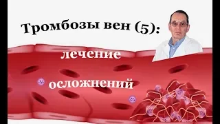 Тромбоз вен (5).Осложнения. Профилактика и лечение  посттромботической болезни. Знания для ВСЕХ.