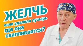 Где скапливается желчь после удаления желчного пузыря?