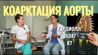 Коарктация аорты в 30+. Роды с коарктацией аорты. Кардиолог. ЭхоКГ -как не пропустить коарктацию. КТ