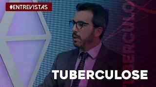 Tudo o que você precisa saber sobre a tuberculose