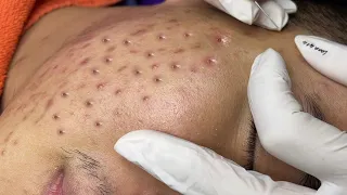 Satisfying With Loan Nguyen Spa Video #014