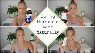 Hormonal Acne Update | PCOS | How I Cured My Acne