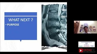 DR RAM CHADDHA : Decision making in Lumbar Disc Herniation