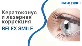 Кератоконус и лазерная коррекция зрения ReLEx SMILE - можно ли делать?