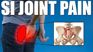 SI JOINT PAIN (SACROILIAC) BEST Exercises, Stretches & Advice for Back & Buttock Pain Relief