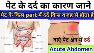 पेट के किस part मैं किस वजह से pain होता है || Acute abdomen || Stomach pain causes