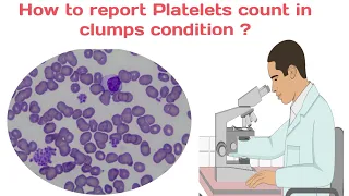 Platelets count/How to do platelets count /clumps platelets/platelets count manual