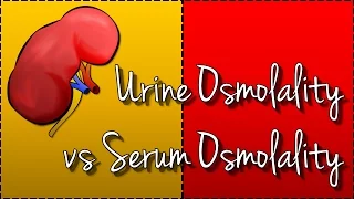 Urine Osmolality vs Serum Osmolality (Hyponatraemia)