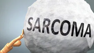 How are Sarcomas Diagnosed?