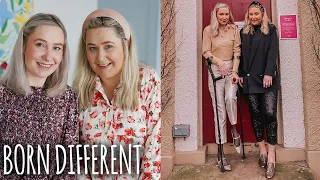 The Twins Who Are Both Turning To Stone | BORN DIFFERENT