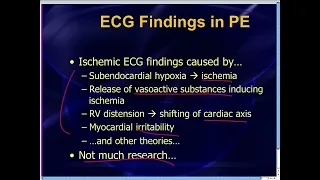 Amal Mattu's ECG Case of the Week_ May 19, 2014