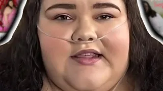 'Fat Acceptance' has gone too far