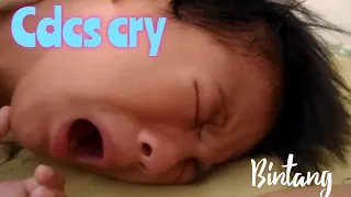 Bintang crying (Cri du chat syndrome).