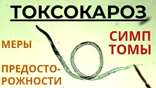 ТОКСОКАРОЗ: ЧТО ЭТО ТАКОЕ? Паразитология. Выпуск 81.