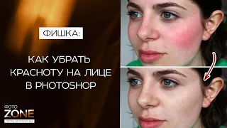 Как убрать красноту на лице в Photoshop. Убираем красные пятна с лица в фотошопе / Петр Михайлуца