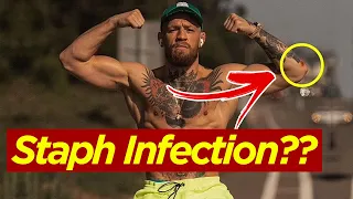 Conor McGregor denied having a staph infection