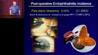 Post Operative Endophthalmitis