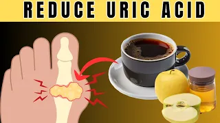 Gout Got You Down? 8 Powerful Foods to LOWER Uric Acid! (Naturally!)