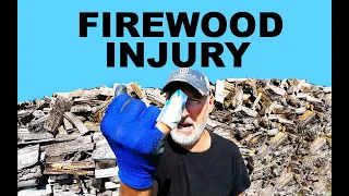 Injury while processing Firewood!