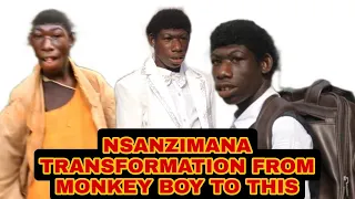 Massive Reactions As The Boy Looks Like Monkey Hardly Bieng Recognized...Nsanzimana  #borndifferent