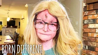 EB Took My Hands And My Hair - But Not My Spirit | BORN DIFFERENT