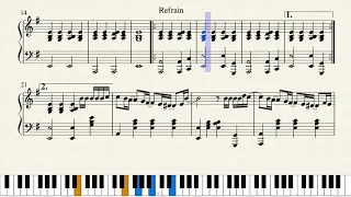 Lomepal - Trop beau (partition piano)
