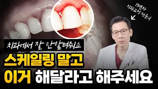 치과에서 잘 안말해주는 가성비 시술, 꼭 해달라고 하세요