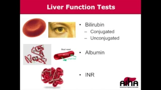 Liver function and tests for the AIH patient John Holden AIHA 2017
