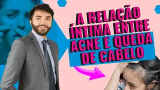 ACNE E QUEDA DE CABELO: principais causas e como tratar | Dr Lucas Fustinoni