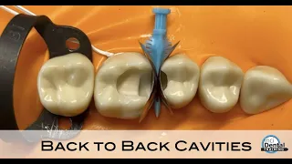 Back to Back Cavity Tutorial