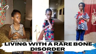 Born Different? 🤔 Uncovering My Extraordinary Life With A Rare Disorder