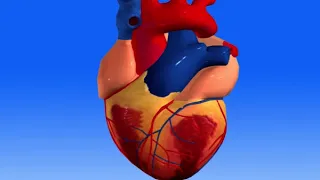 Animation 22.2 Cause of coronary heart disease