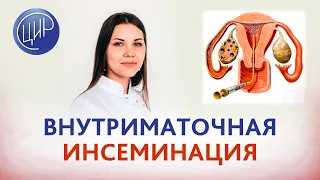 Внутриматочная инсеминация: показания, противопоказания, как выполняется искусственная инсеминация.