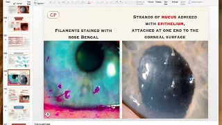 Non infective keratitis