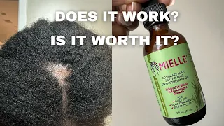 DOES THE MIELLE ROSEMARY MINT GROWTH OIL WORK ON MY BALD SPOT? 1 MONTH RESULTS