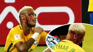 The moment of all injuries in Neymar Jr