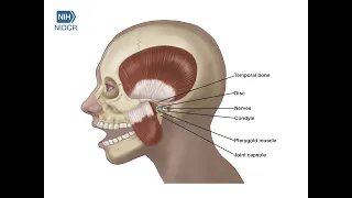 Normal TMJ in Motion