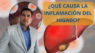 HEPATITIS: ¿cuales son las causas que provocan la inflamación de tu hígado?
