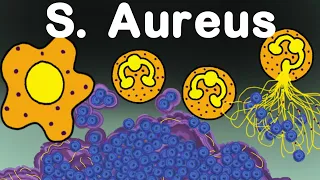 Staphylococcus Aureus vs Immune System