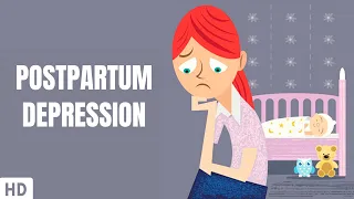 Postpartum Depression (Part-2)