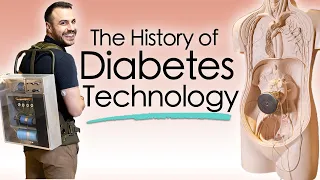 The Journey to an Artificial Pancreas