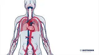 Sydän ja verenkiertoelimistö - miten ne toimivat