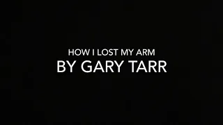 [WATCH] How I lost my arm