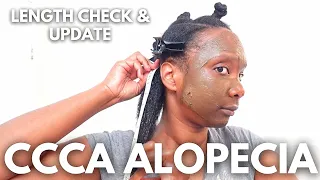 CCCA Alopecia Hair & Scalp Care | Length Check & Update #alopecia