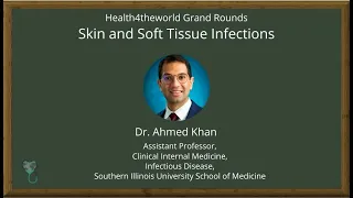 Skin and Soft Tissue Infections