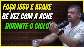 COMO ACABAR COM A ACNE DURANTE O CICLO - ROMULO JOGAIB