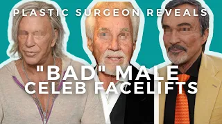 Men's Facelift Surgery: Mickey Rourke, Kenny Rogers, Burt Reynolds