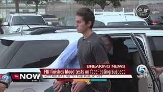 FBI finishes tests on face-eating suspect