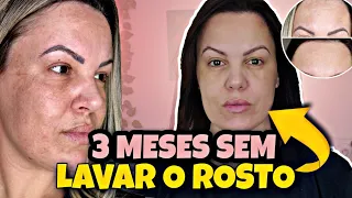 ROTINA DE SKINCARE QUE MUDOU MINHA PELE *oleosa e com melasma*