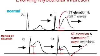 Chapter 1 ACSM Guidelines Notes